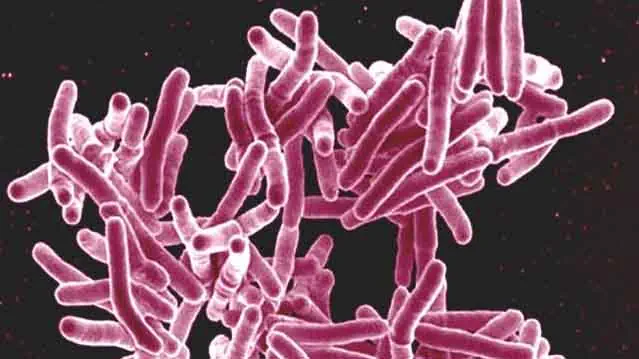 "Mycobacterium tuberculosis Bacteria, the Cause of TB" by NIAID licensed under CC BY 2.0